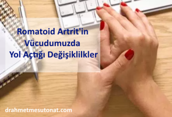 Romatoid Artrit'in Vücudumuzda Yol Açtığı Değişiklilkler